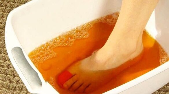 bagno allo iodio contro i funghi dei piedi