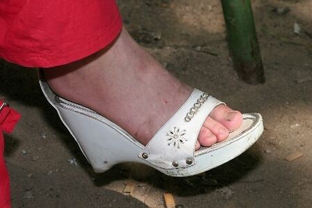 pelle secca sulle gambe